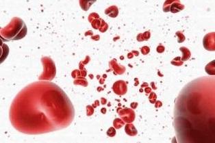 警惕血尿 危害不一般！