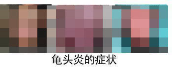 龟头炎的初期症状有哪些?